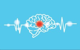 apa-itu-stroke-gajala-dan-penyebabnya